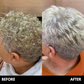 Medihair Straight 200g White