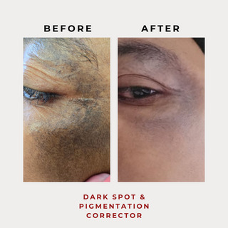 Dark Spot & Pigmentation Corrector 30g